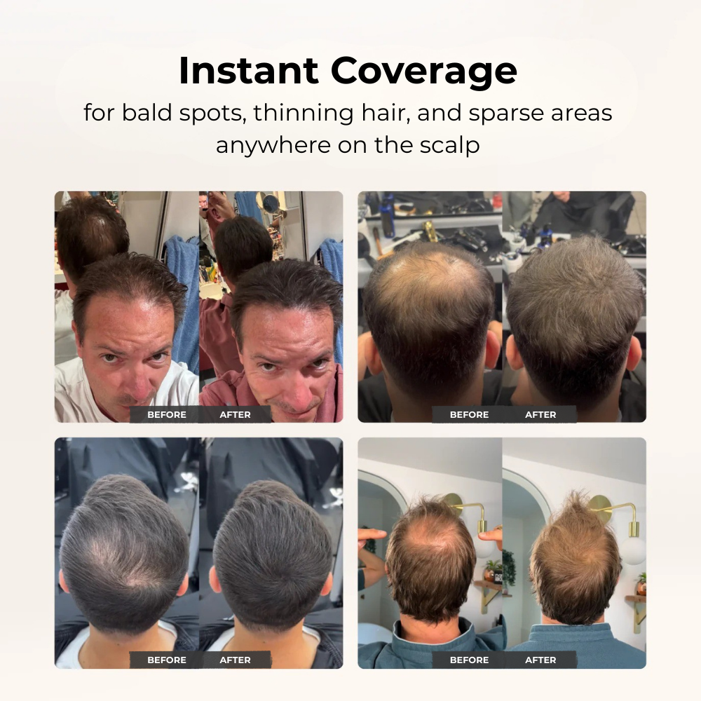 Remplissage de densité capillaire